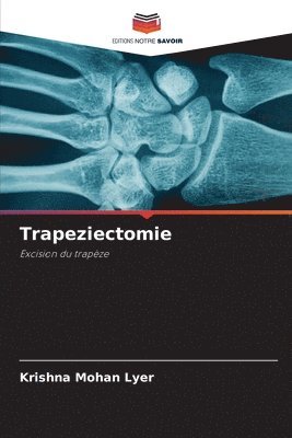 Krishna Mohan Lyer - Trapeziectomie, Häftad