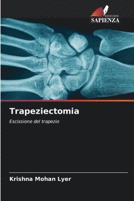 bokomslag Trapeziectomia