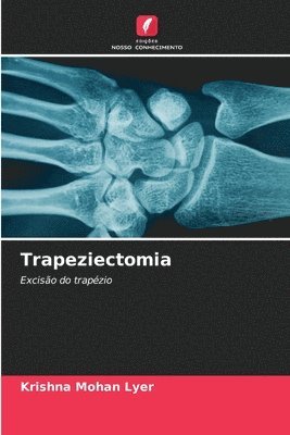 bokomslag Trapeziectomia