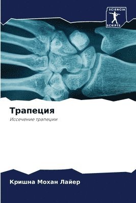 Трапеция