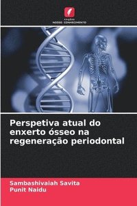 bokomslag Perspetiva atual do enxerto ósseo na regeneração periodontal