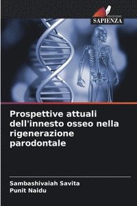 bokomslag Prospettive attuali dell'innesto osseo nella rigenerazione parodontale