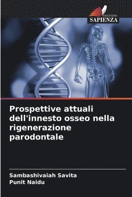 Prospettive attuali dell'innesto osseo nella rigenerazione parodontale 1