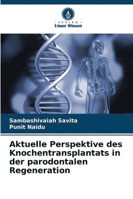 Aktuelle Perspektive des Knochentransplantats in der parodontalen Regeneration