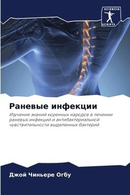 &#1056;&#1072;&#1085;&#1077;&#1074;&#1099;&#1077; &#1080;&#1085;&#1092;&#1077;&#1082;&#1094;&#1080;&#1080; 1