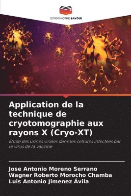 Application de la technique de cryotomographie aux rayons X (Cryo-XT)