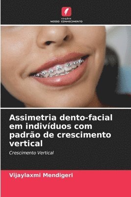 Assimetria dento-facial em indivduos com padro de crescimento vertical 1