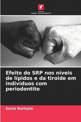 bokomslag Efeito do SRP nos nveis de lpidos e da tiroide em indivduos com periodontite