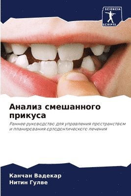 Анализ смешанного прикуса