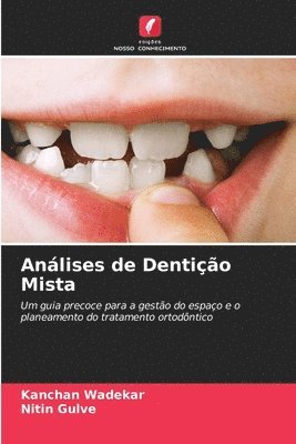 Kanchan Wadekar, Nitin Gulve - Análises de Dentição Mista, Häftad