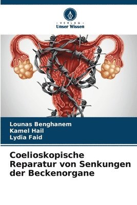 bokomslag Coelioskopische Reparatur von Senkungen der Beckenorgane