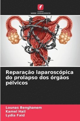 bokomslag Reparao laparoscpica do prolapso dos rgos plvicos