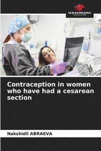 bokomslag Contraception in women who have had a cesarean section