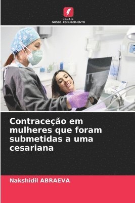 Contraceção em mulheres que foram submetidas a uma cesariana