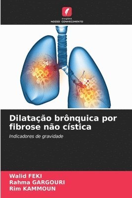 bokomslag Dilatao brnquica por fibrose no cstica