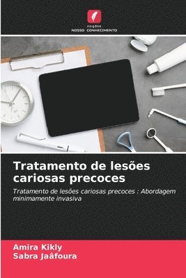 bokomslag Tratamento de leses cariosas precoces