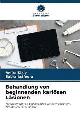 Behandlung von beginnenden karisen Lsionen 1