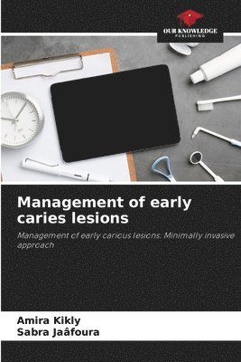 bokomslag Management of early caries lesions