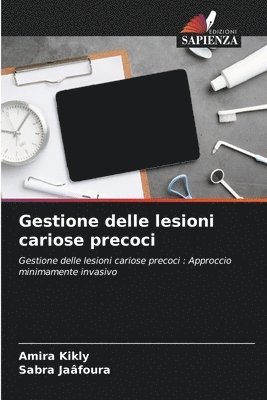 Gestione delle lesioni cariose precoci 1