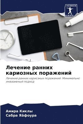 Амира Киклы, Сабра Яâфоура, &#1 &#1050;&#1080;&#1082;&#1083;&#1099;, &#1071;â&#1092;&#1086;&#1091;&#1088;&#10, ¿¿¿¿¿ ¿¿¿¿¿, ¿¿¿¿¿ ¿â¿¿¿¿¿, Amira Kikly - Лечение ранних кариозных поражений, Häftad