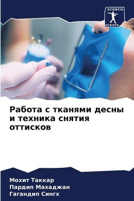 Работа с тканями десны и техника снятия от&#10