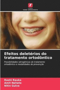 bokomslag Efeitos deletrios do tratamento ortodntico