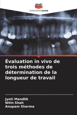 bokomslag valuation in vivo de trois mthodes de dtermination de la longueur de travail