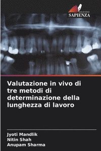 bokomslag Valutazione in vivo di tre metodi di determinazione della lunghezza di lavoro