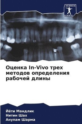 &#1054;&#1094;&#1077;&#1085;&#1082;&#1072; In-Vivo &#1090;&#1088;&#1077;&#1093; &#1084;&#1077;&#1090;&#1086;&#1076;&#1086;&#1074; 1