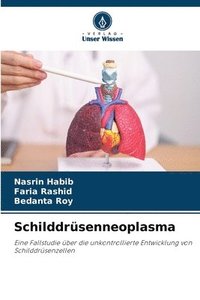 bokomslag Schilddrsenneoplasma