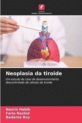 bokomslag Neoplasia da tiroide