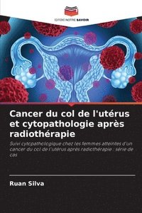 bokomslag Cancer du col de l'utrus et cytopathologie aprs radiothrapie