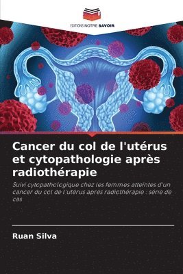 bokomslag Cancer du col de l'utérus et cytopathologie après radiothérapie