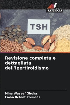 Mina Wassef Girgiss, Eman Refaat Youness - Revisione completa e dettagliata dell'ipertiroidismo, Häftad