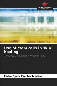 bokomslag Use of stem cells in skin healing