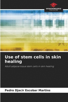 Use of stem cells in skin healing 1