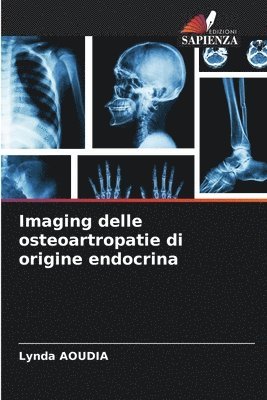 bokomslag Imaging delle osteoartropatie di origine endocrina