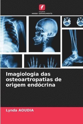 Lynda Aoudia - Imagiologia das osteoartropatias de origem endócrina, Häftad