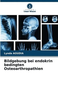 bokomslag Bildgebung bei endokrin bedingten Osteoarthropathien