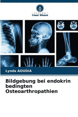 Bildgebung bei endokrin bedingten Osteoarthropathien 1