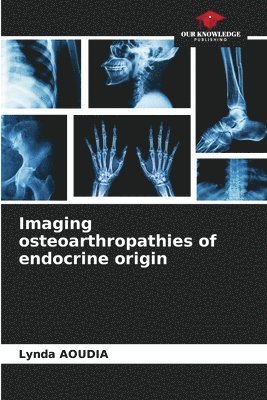 bokomslag Imaging osteoarthropathies of endocrine origin