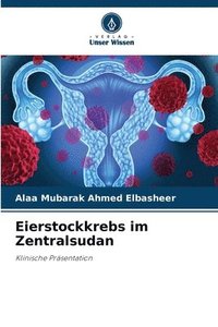 bokomslag Eierstockkrebs im Zentralsudan