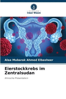 bokomslag Eierstockkrebs im Zentralsudan