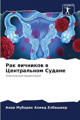 Рак яичников в Центральном Судане