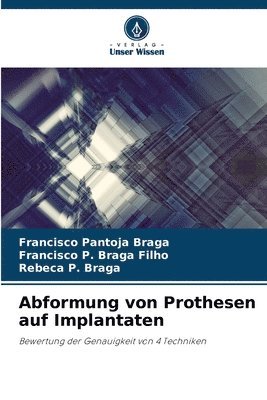 bokomslag Abformung von Prothesen auf Implantaten