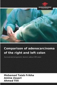 bokomslag Comparison of adenocarcinoma of the right and left colon