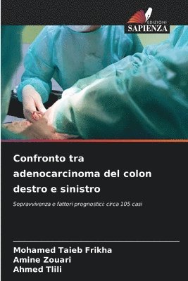 bokomslag Confronto tra adenocarcinoma del colon destro e sinistro