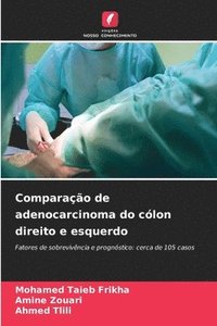 bokomslag Comparao de adenocarcinoma do clon direito e esquerdo