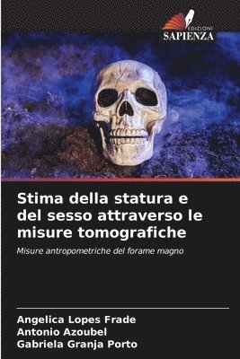 bokomslag Stima della statura e del sesso attraverso le misure tomografiche