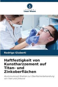 bokomslag Haftfestigkeit von Kunstharzzement auf Titan- und Zinkoberflchen